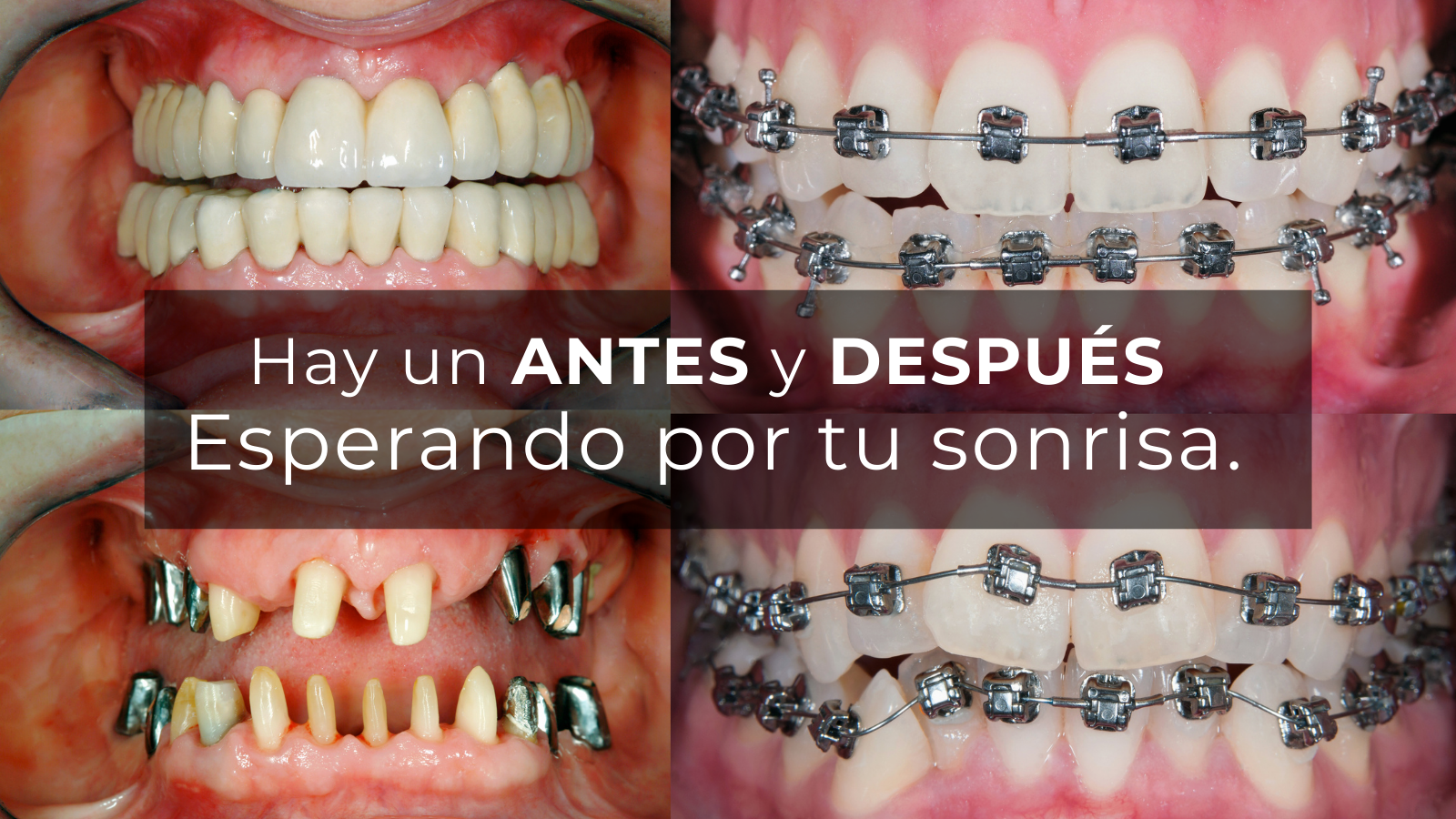 Antes y Después